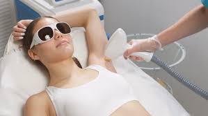 cosmocare underarms laser hair removal